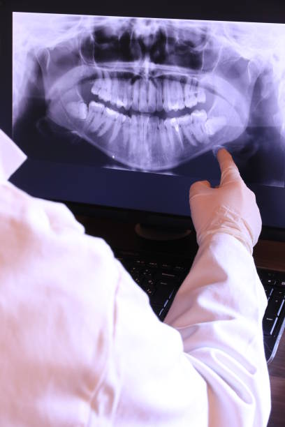 Best Emergency Gum Treatment in Newton Falls, OH