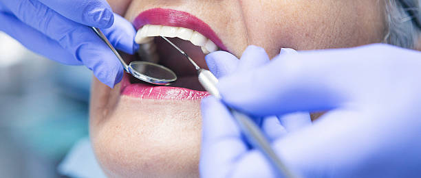Best Emergency Wisdom Teeth Removal in Newton Falls, OH